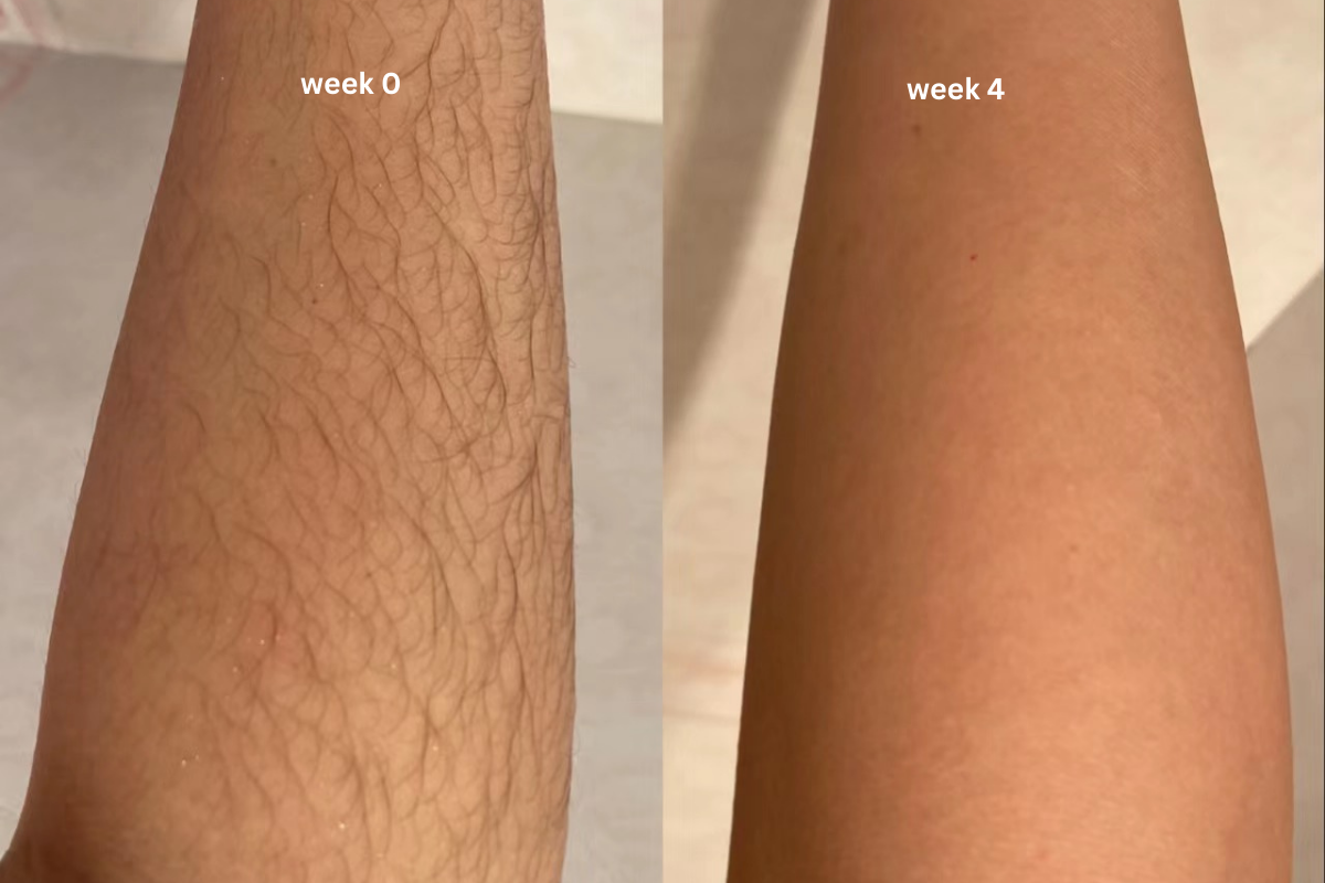 With so many influencer brands, Vavame stood out with its focus on product and tech. After 4 weeks, I saw results—almost no hair growth by week 4. Now I use it once a month and haven’t shaved since!