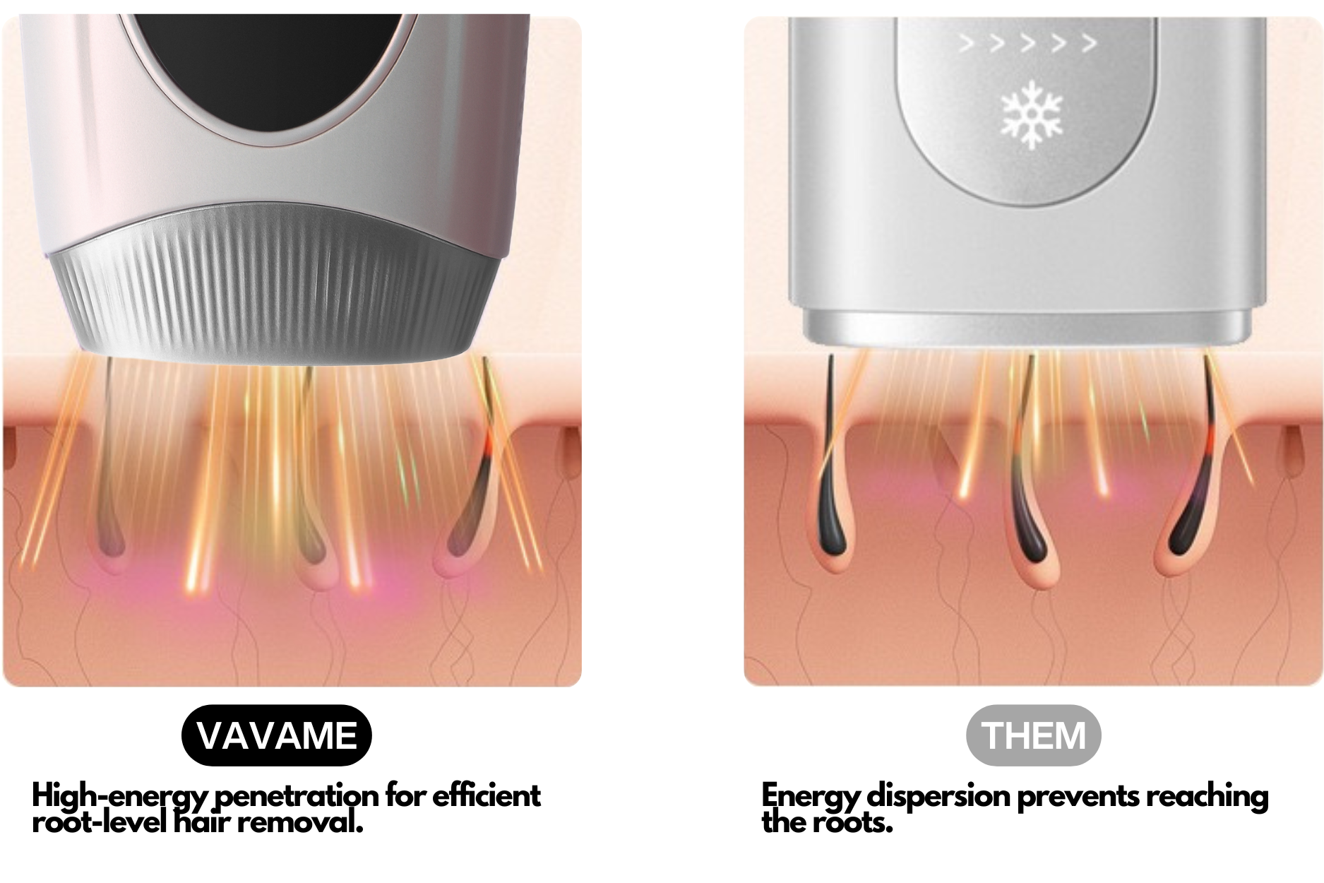 vavame ipl hair removal handset is better than the others, as vavame IPL has high-energy penetration for efficient root-level hair removal.